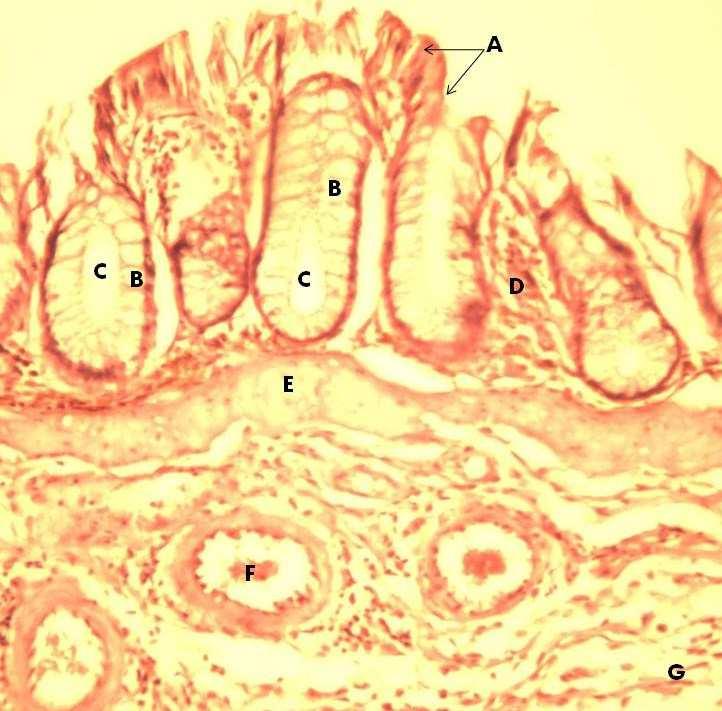 Plate VI: Transverse section of the rectum showing the absorptive columnar cells (A), goblet cells (B),intestinal glands (C), laminar Propria (D), muscularis mucosa (E), blood vessels (F), submucosa