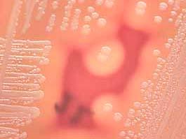 M R S A Methicillin-Resistant Staphylococcus aureus The Facts Michael Parry, M.D.