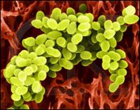 Staphylococcus aureus Most common staph bacteria Carried in skin or nose in