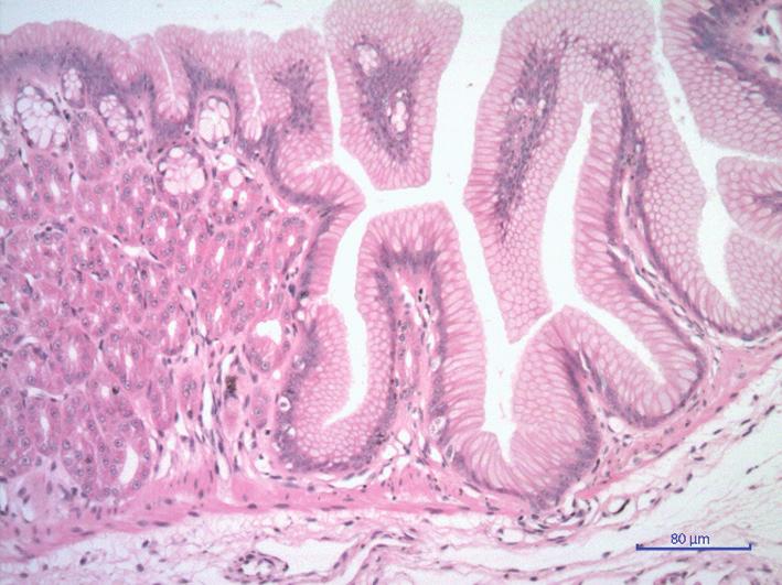 This picture is fairly representative of the esophageal wall s layers, as well as the two directions - circular and longitudinal - smooth muscle bundles of muscle layer Stomach The macroscopic