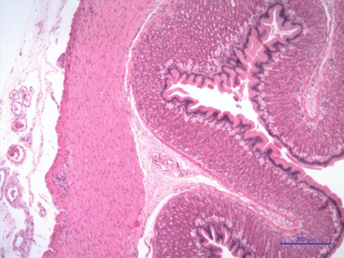 However, histologically, this transition was only distinguishable between the cardia and the fundus, as the cardia retained the morphology of the terminal portion of the esophagus, which confounds