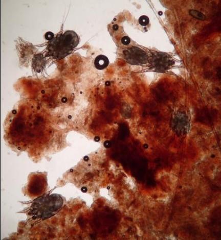 Diagnosis Black to reddish-black exudate found in ear canal Otoscopic examination to visualize mites in ear canal Microscopic examination of ear swab 6.