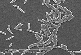 Multi-Drug Resistant Acinetobacter Acinetobacter is a gram-negative bacterium that is often found in soil and water and on the skin of healthy people, particularly healthcare