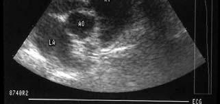Echocardiography Necropsy Diagnosis May Be Difficult Disease may be related to very small immature adults Current clinical disease may be related to prior infection Small worm fragments may be