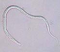 immitis microfilariae (bottom) Stages within the uterus of females of Dirofilaria immitis Male Developed Embryo Pretzel Stage Stretch Microfilaria < 5.