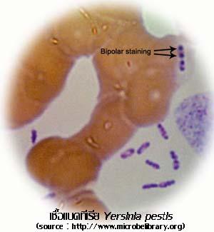1. Bipolar staining Gm