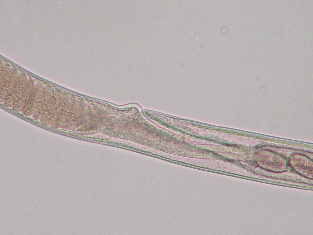 Hair-like worms of Capillaria spp.
