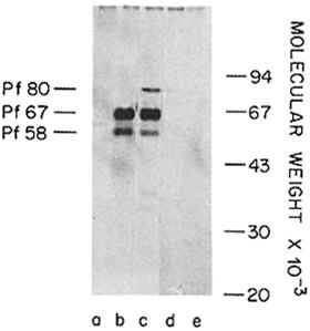 24 CIRCUMSPOROZOITE PROTEINS OF HUMAN MALARIA PARASITES Fro. 1. Analysis of SDS-PAGE of [~OS]methionine-labeled P.