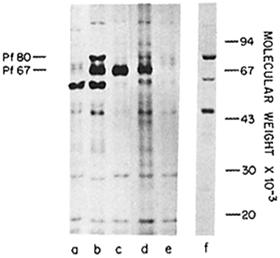 protected against P. falciparum sporozoites (track c). The radiolabeled P. falciparum sporozoite extract was also reacted with serum of a human volunteer immunized against P.