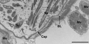 Transmission electron micrograph of immunogold labelling of laminin in a P.