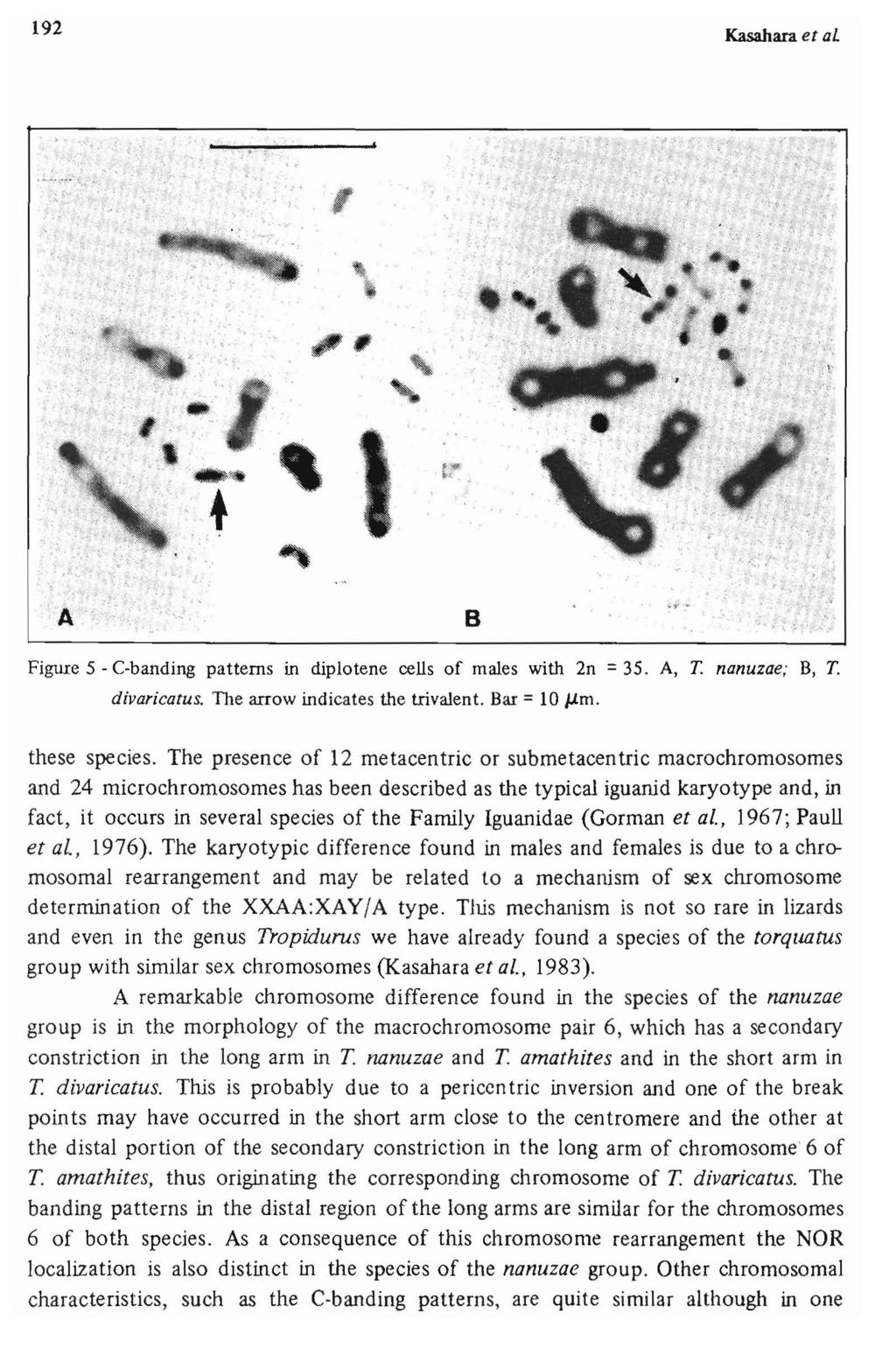 192 Kasahara et al:, '., ", \,", " Figure 5 - C-banding patterns in diplotene cells of males with 2n =35. A, T. nanuzae; B, T. divaricatus. The arrow indicates the trivalent.