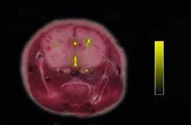 MSOT can be used to accurately determine the spatial biodistribution of probes in the mouse brain through an intact skin and skull.