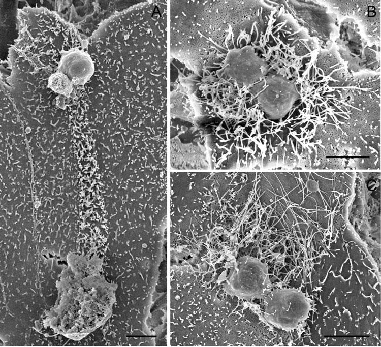 H. Borowski and others 18 Fig. 3. The parasite s effect on host cell microvilli. (A) Gliding trail composed of elongated microvilli between an excysted oocyst and trophozoites 3 days post-inoculation.