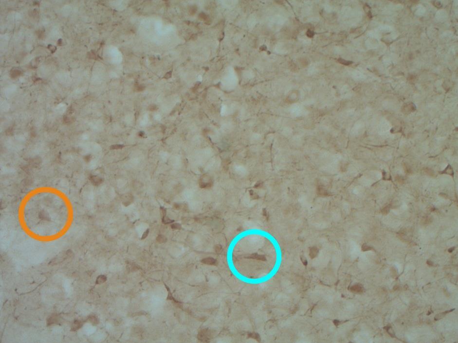 CORTICOSTERONE 13 Figure 1. A section of the HVC. The cyan circle is highlighting a fusiform cell meanwhile the orange circle is highlighting a round cell.