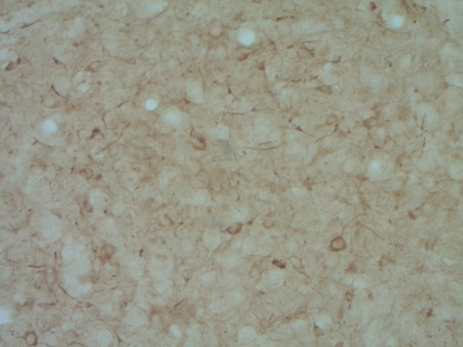 CORTICOSTERONE 20 Figure 9. Cells in the HVC. Figure 10. Cells in the hippocampus.