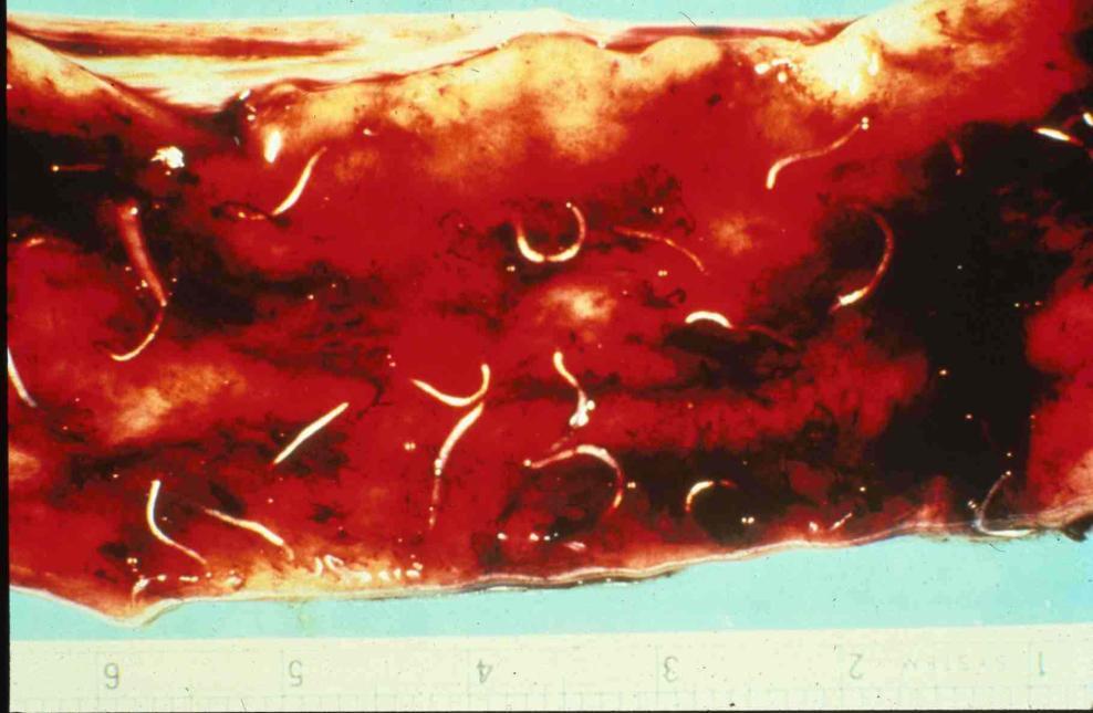 Blood-feeding parasites