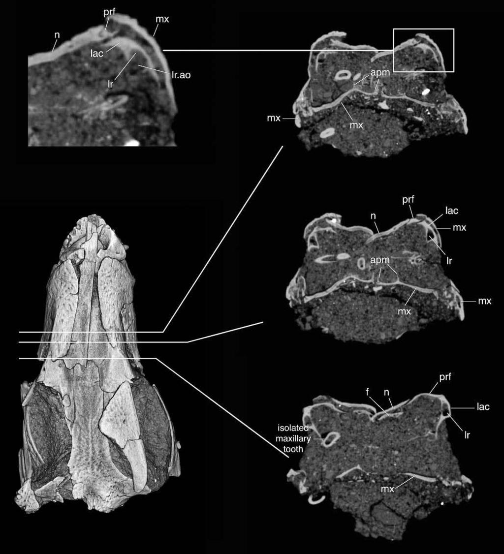 280 A. H. Turner Figure 23. UA 8720, Araripesuchus tsangatsangana. Coronal CT slices through the posterior portion of the rostrum, showing internal lacrimal and lacrimal recess morphology.