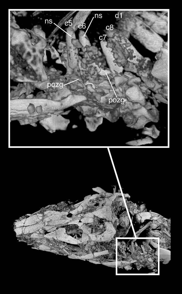 Series of sagittal CT sections through the axis vertebra, showing the shape and position of the neural spine. Sections do not exactly bisect vertebra and spine.