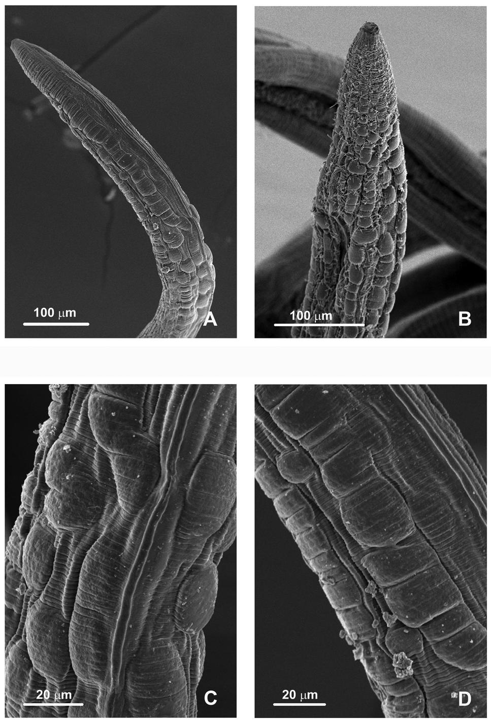 FIGURE 2. Scanning electron micrographs of Gongylonema archboldi n. sp. A. Male, anterior end with prominent cuticular bosses, ventro-lateral view. B.