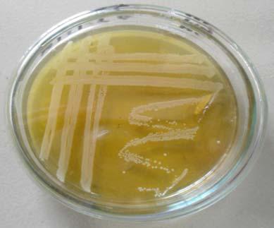 coli were successfully isolated from the nasal swab of healthy horse.