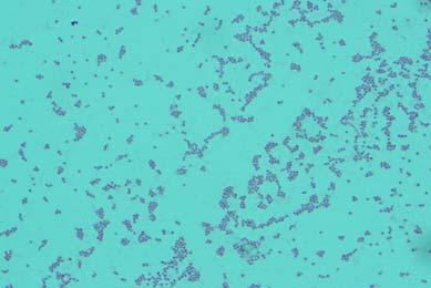 amoxicilin Fig. 1. Metallic sheen of E.coli on EMB agar Fig. 2. Pink colour colony of E.