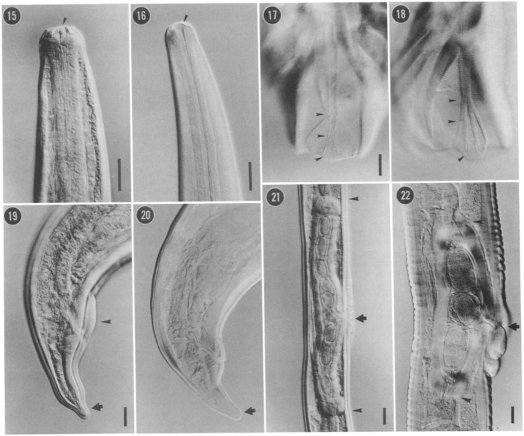 HOBERG ET AL.-TRICHOSTRONGYLES FROM OSTRICHES 91.:cc -116 FIGURES 15-22. Comparison of key morphological characters for the identification of L. dentatus n. sp. and L.