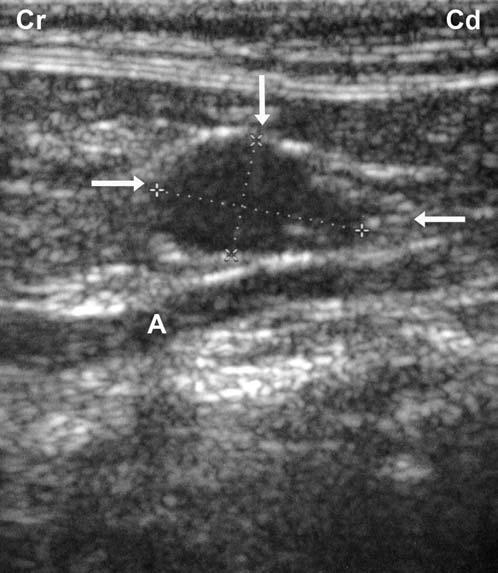 80 JOURNAL of the American Animal Hospital Association March/April 2007, Vol. 43 Figure 1 A longitudinal sonogram of a left adrenal gland (between the arrows) in a 3.