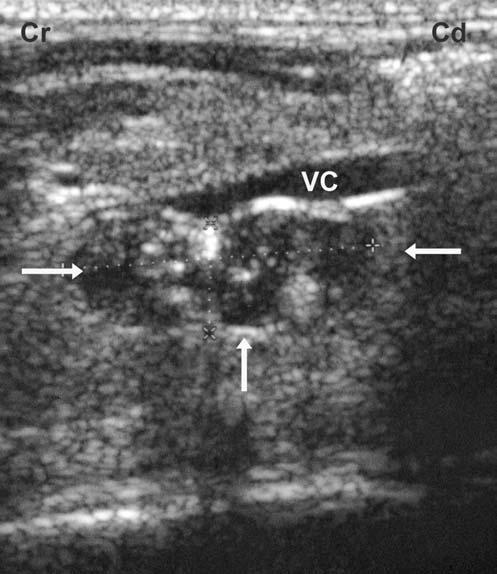 Note the location of the adrenal gland ventrolateral to the aorta (A). The top of the image is ventral, Cr=cranial, Cd=caudal. A was rotated 90 to obtain transverse images [Figure 2B].