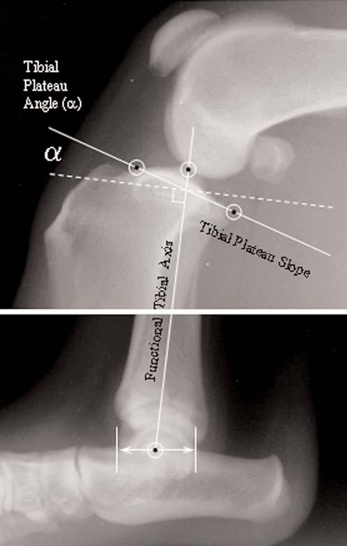 March/April 2007, Vol. 43 Tibial Plateau Symmetry 95 Radiographic Evaluation Tibial plateau angles were measured to the nearest 0.5 using landmarks previously described [Figure 2].