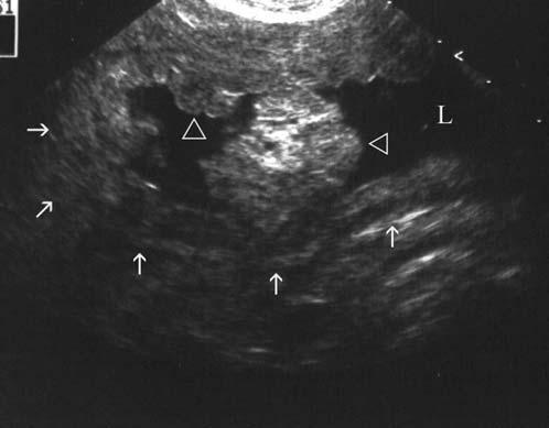 Figure 2 Longitudinal ultrasonographic image of the stomach of the dog in Figure 1, showing thickened, lobulated folds and vegetative-like structures (arrowheads) protruding into the lumen (Arrows