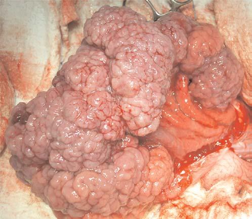 No regional lymphadenopathy was observed, and no gross lesions of the liver, pancreas, duodenum, kidneys, or omentum were identified.