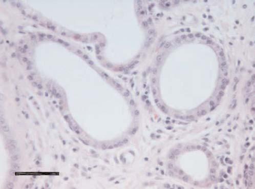 A mild mononuclear inflammatory infiltration (arrow) is present (Hematoxylin and eosin stain; bar=500 µm).
