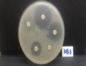 3% and 76.5% resistant to ciprofloxacin, and also different from the research Bhaskara (2012) in Bogor produce that Escherichia coli high resistance to chloramphenicol of 57.1%. (a) (b) FIGURE 1. (a). E.coli on EMB Agar (b).