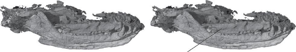 29 (a) (b) para-maxillary ridge 0 mm (c) 0