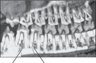 Autapomorphies of Juchilestes include columnar and high crowned canines, a raised and arcuate alveolar margin of the lower incisors, lanceolate posterior incisors and a distinctive para-maxillary
