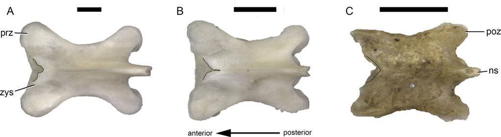 Fig 4. Different morphologies of the TPRL in dorsal vertebrae of Lacertini (black lines): Lacerta trilineata MDHC 240 (A), L.