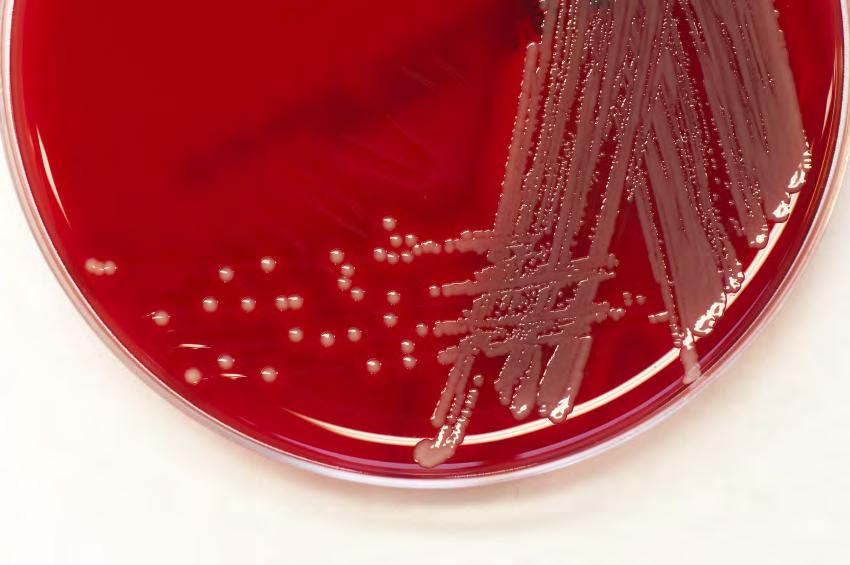MRSA: How to Keep This Deadly Super Bug From Infecting You DR. MERCOLA $9.