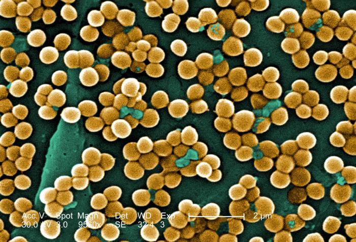 Methicillin Resistant Staphylococcus Aureus (MRSA) The drug resistant `Superbug that won t die Michael A. Miller, MD Assistant Professor of Pediatrics -Jacksonville OBJECTIVES 1.