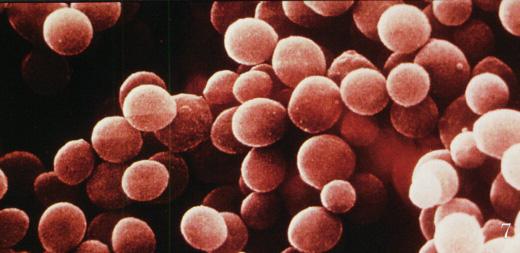 Conclusions New strains of MRSA have emerged in the community, with implications for the management staphylococcal infections The incidence of MRSA at Baptist Medical Center was 66% SSTIs are the