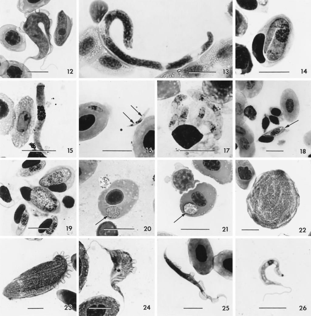 156 THE JOURNAL OF PARASITOLOGY, VOL. 87, NO. 1, FEBRUARY 2001 FIGURES 12 26. Photomicrographs of hematozoan parasites of R. forreri and R. vaillanti. Scale bar 10 m. 12. sp. (d) in R. forreri. 13.