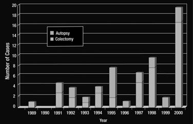 Fulminant C. difficile-associated Disease (CDAD) in Pittsburgh Outbreaks: CDAD in Quebec by Age From Dallal RM, et al. Ann Surg. 22;3:363-372; with permission. From Pépin J, et al. Can Med Assoc J.
