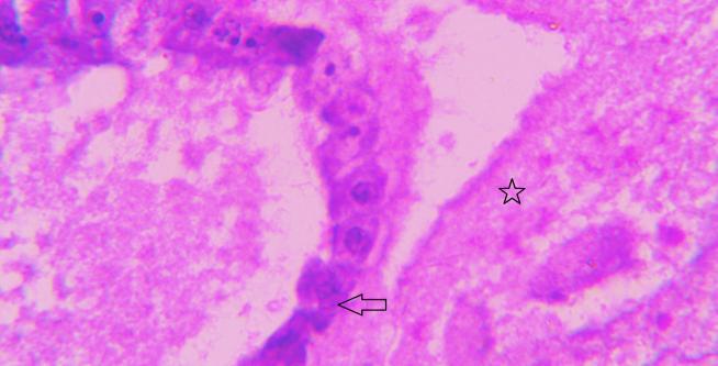 spores (star) and detachment of