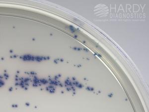 Staphylococcus intermedius (clinical isolate) growing on HardyCHROM MRSA (Cat. no. G307) showing blue colonies. Incubated aerobically for 48 hours at 35 to 37ºC.