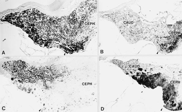 70 Ramesh, Proudman, and Kuenzel FIG. 1. Photomicrographs of midsagittal sections of the anterior pituitary gland immunostained using antibodies against chicken PRL or turkey GH.