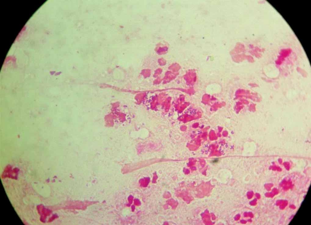 Acinetobacter baumannii Acinetobacter calcoaceticus (complex ABC, specie genomică 1-3, 13).