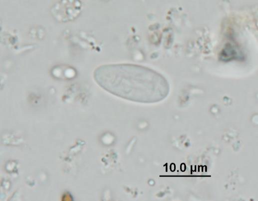 Figure 9.1 Cyst of Giardia peramelis by light microscopy Figure 9.2 Cysts of Giardia peramelis by immunofluorescence microscopy 9.3.