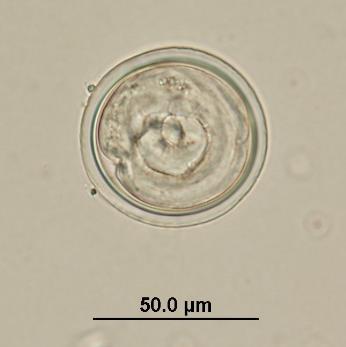 Rhabditomorphia): Unembryonated egg