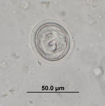 5 µm width: 30 µm 45 µm Labiobulura