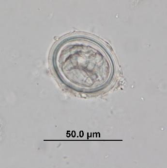 width: 45 µm 60 µm Linstowinema spp.