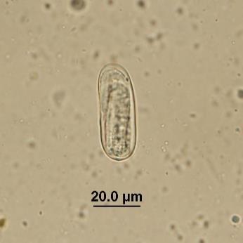 5 µm Strongyloid eggs (Family